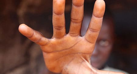 La lutte contre les violences sexuelles liées aux conflits
